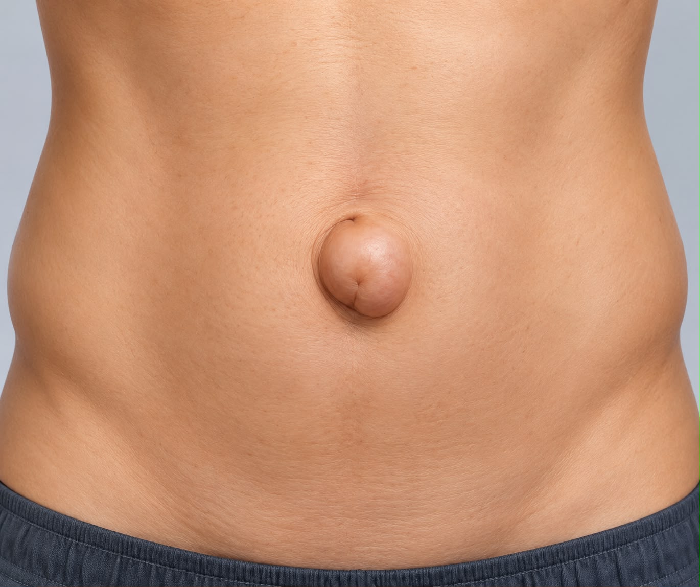 Hernia Surgery - Velura Clinic